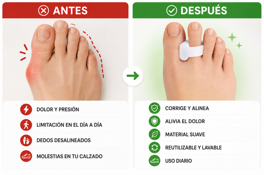 ORTOCLINIC - CORRECTOR DE JUANETES Y DEDOS MONTANTES